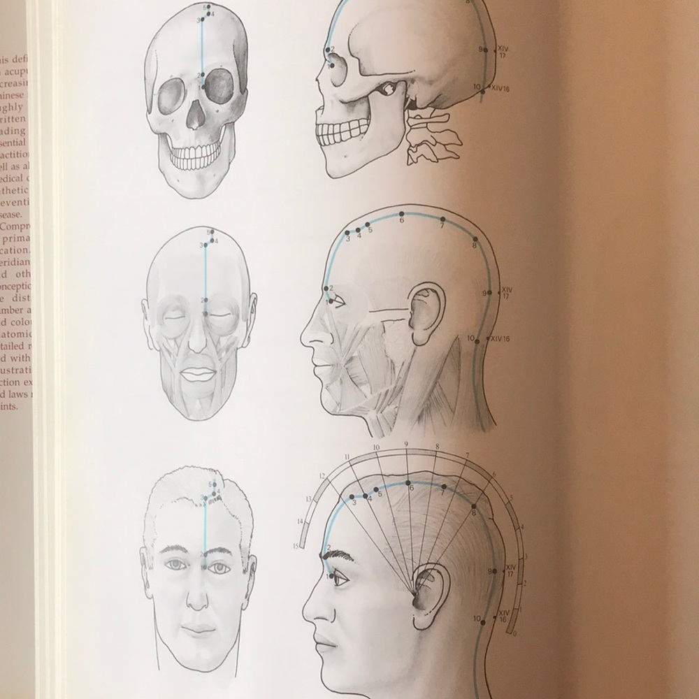 Traditional Chinese ACUPUNCTURE hardback lrge illustrated book newish dustcover - Picture 2 of 12